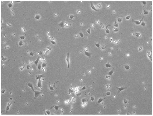 Method for culturing adult mouse cardiac fibroblasts