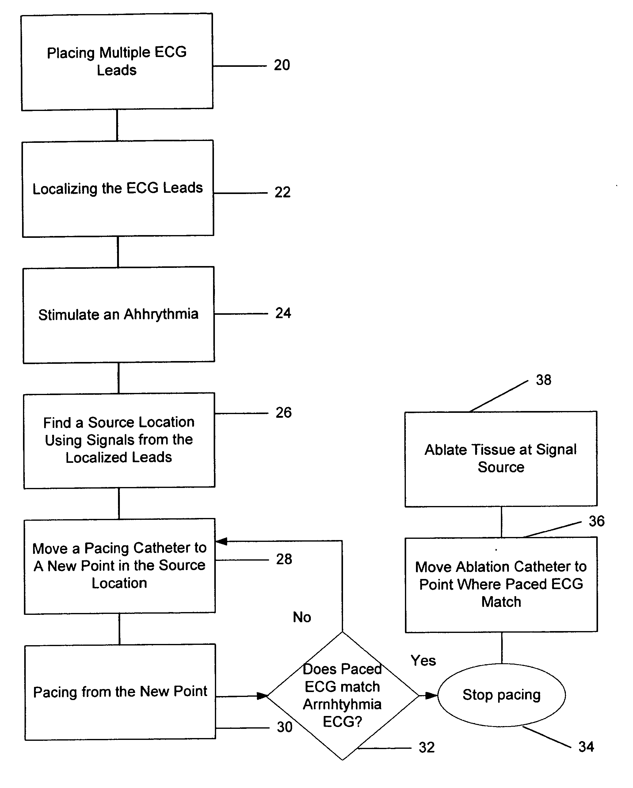 Method of finding the source of and treating cardiac arrhythmias