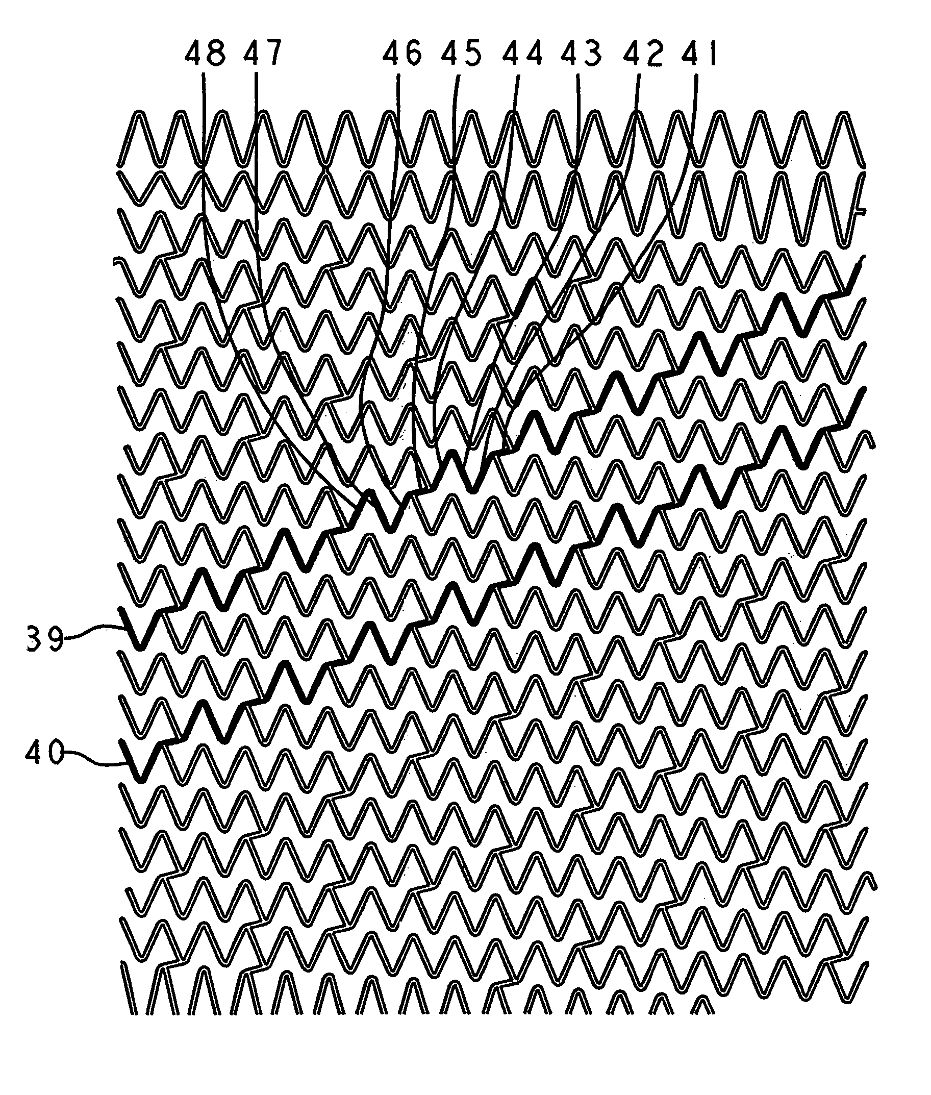 Self-expanding stent