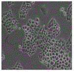 Application of Hypericum longiflorum extract in the preparation of anti-tumor and tumor-inhibiting drugs