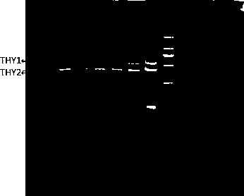 Recombinant thymosin protein PaTHY1 of Periplaneta americana and expression method thereof