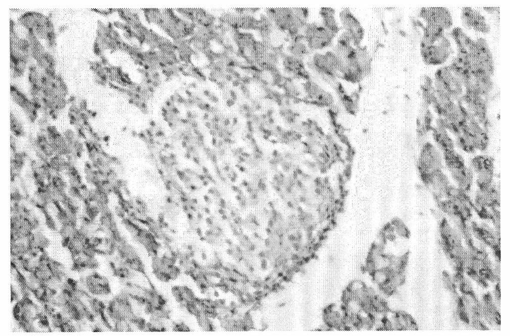 Traditional Chinese medicinal composition, traditional Chinese medicinal preparation, preparation methods and use thereof