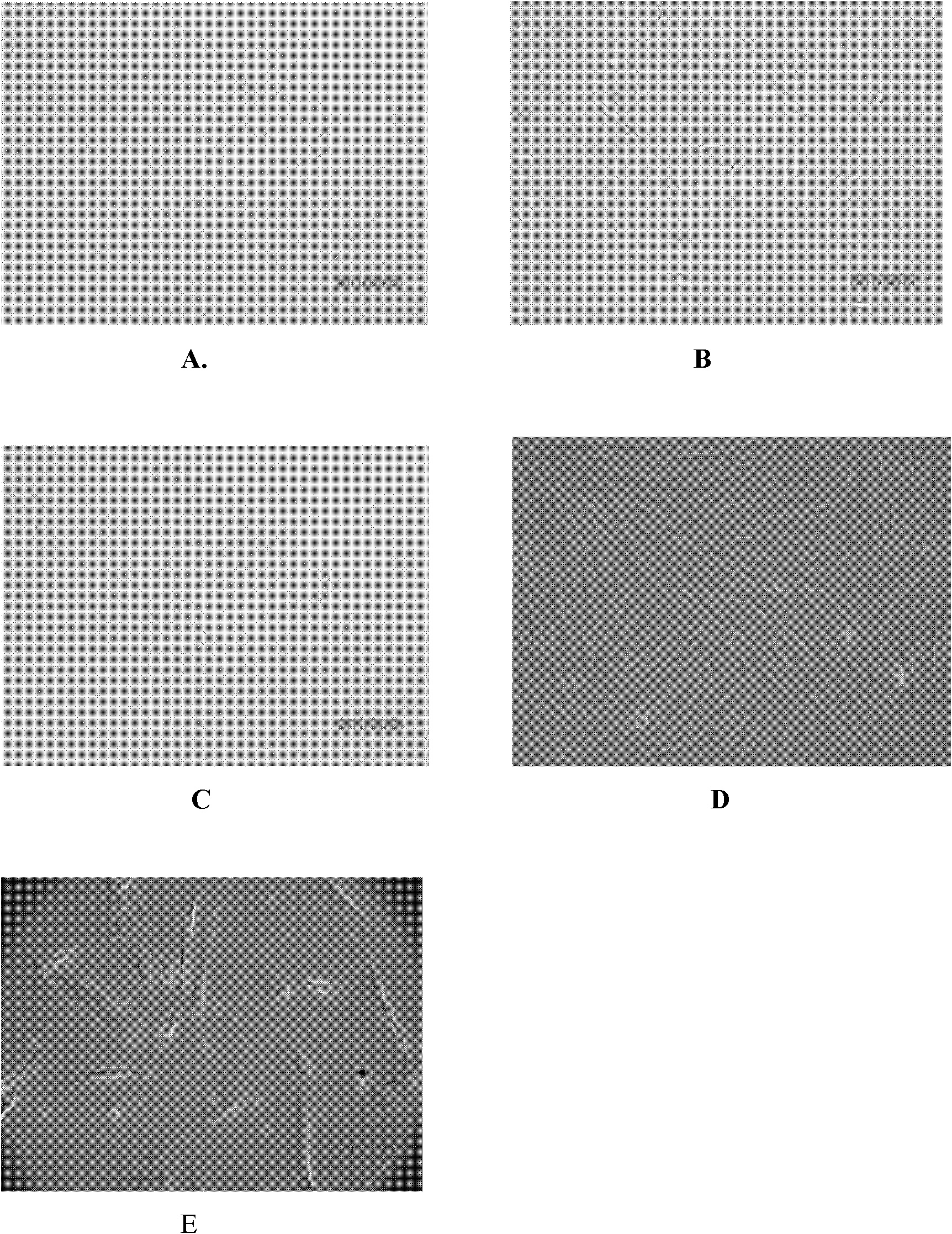 Method for storing endometrial stem cells