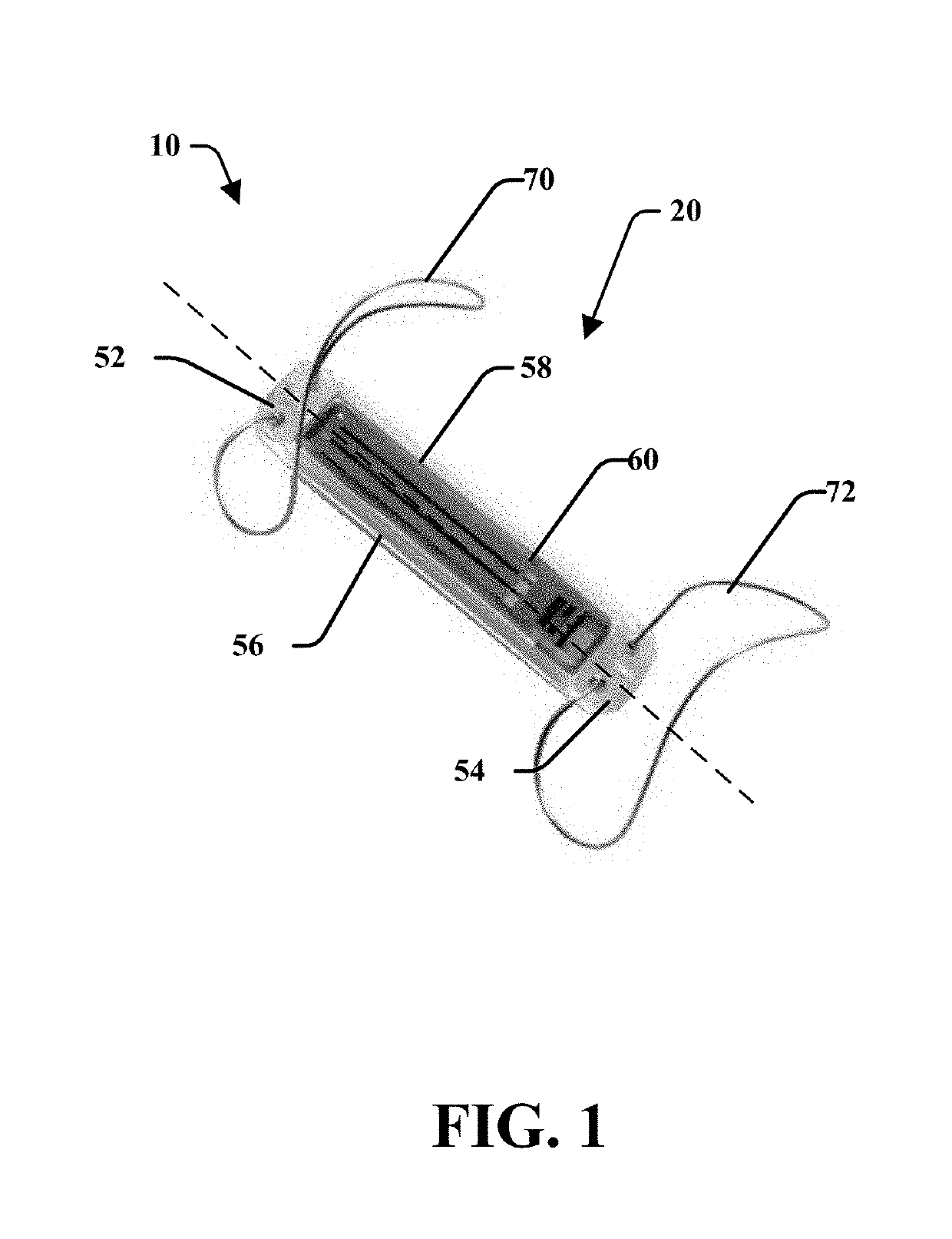 MEMS device for an implant assembly