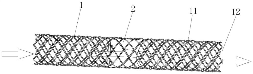 Membrane-carrying stent