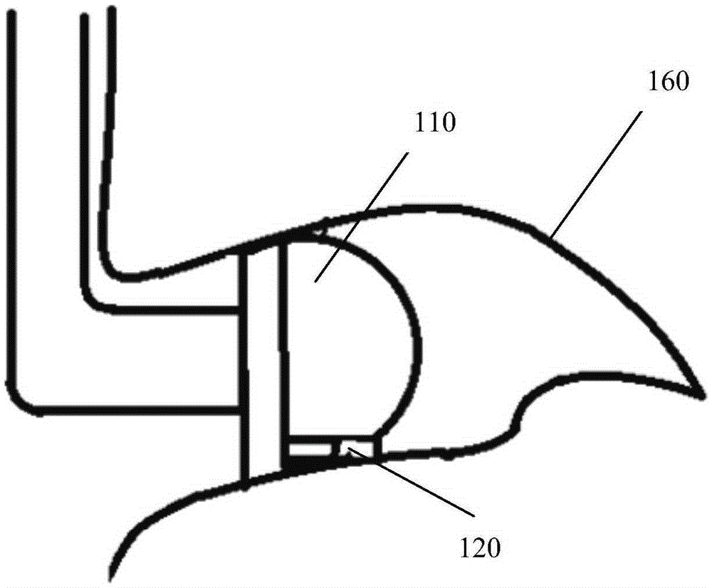 Auditory meatus surface-mounted oxyhemoglobin saturation monitor and system thereof