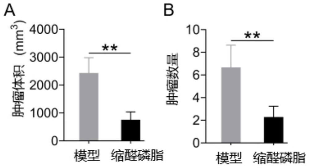 Application of a microbial plasmalogen in the treatment of colon cancer