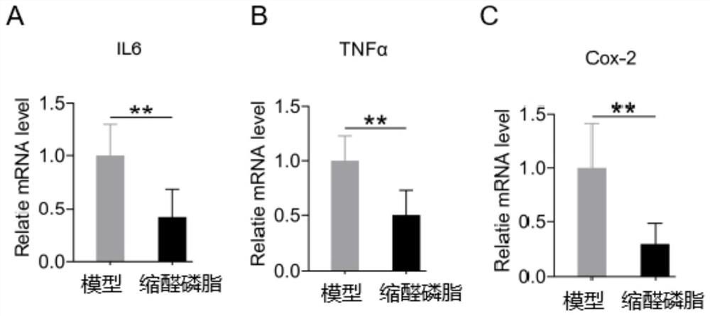 Application of a microbial plasmalogen in the treatment of colon cancer