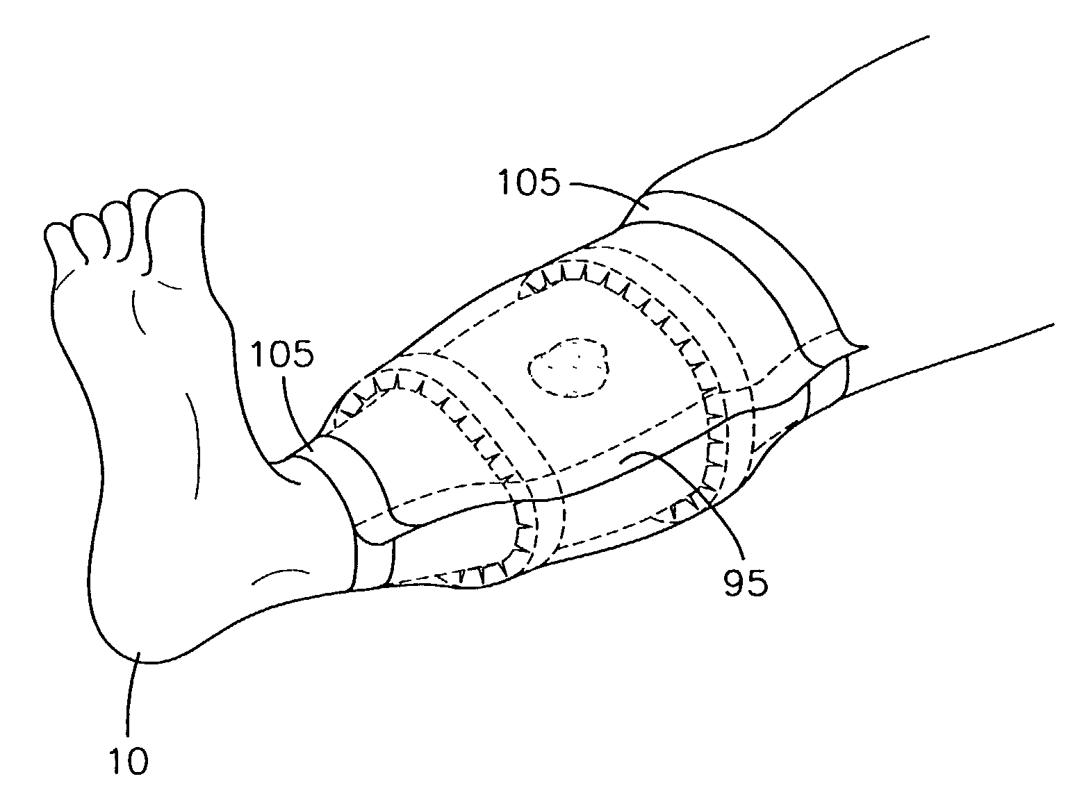 Modular bandage