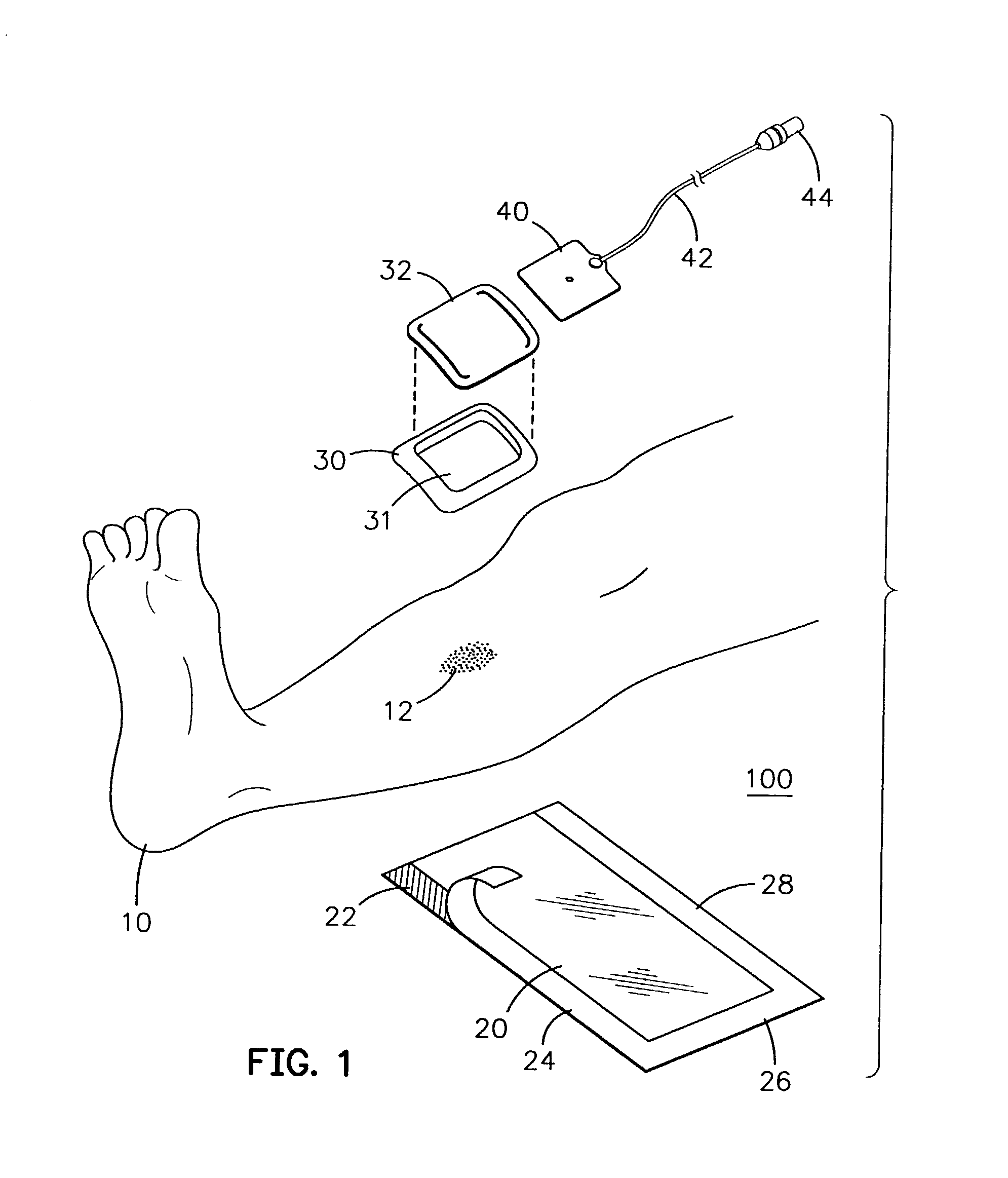 Modular bandage