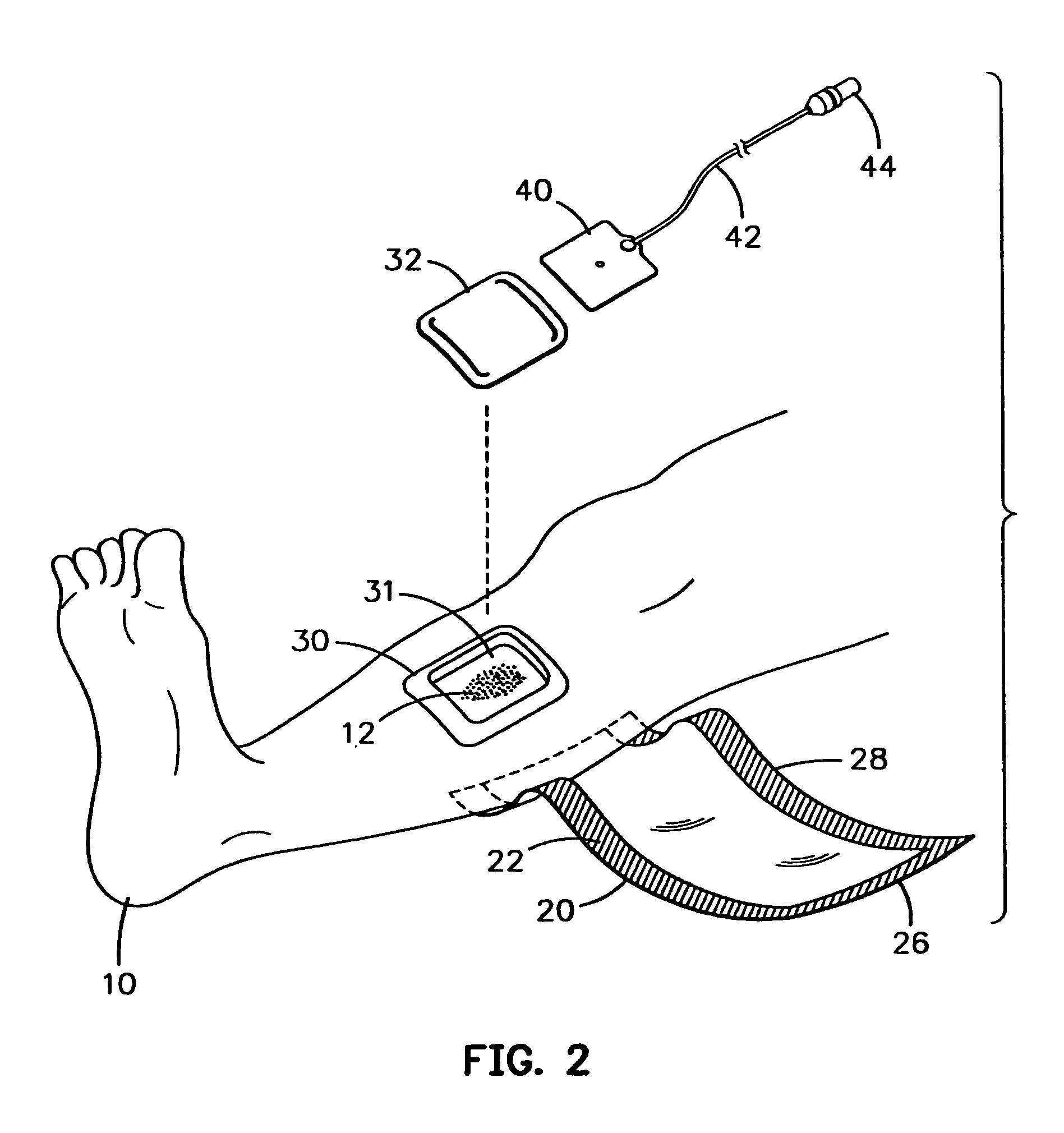 Modular bandage