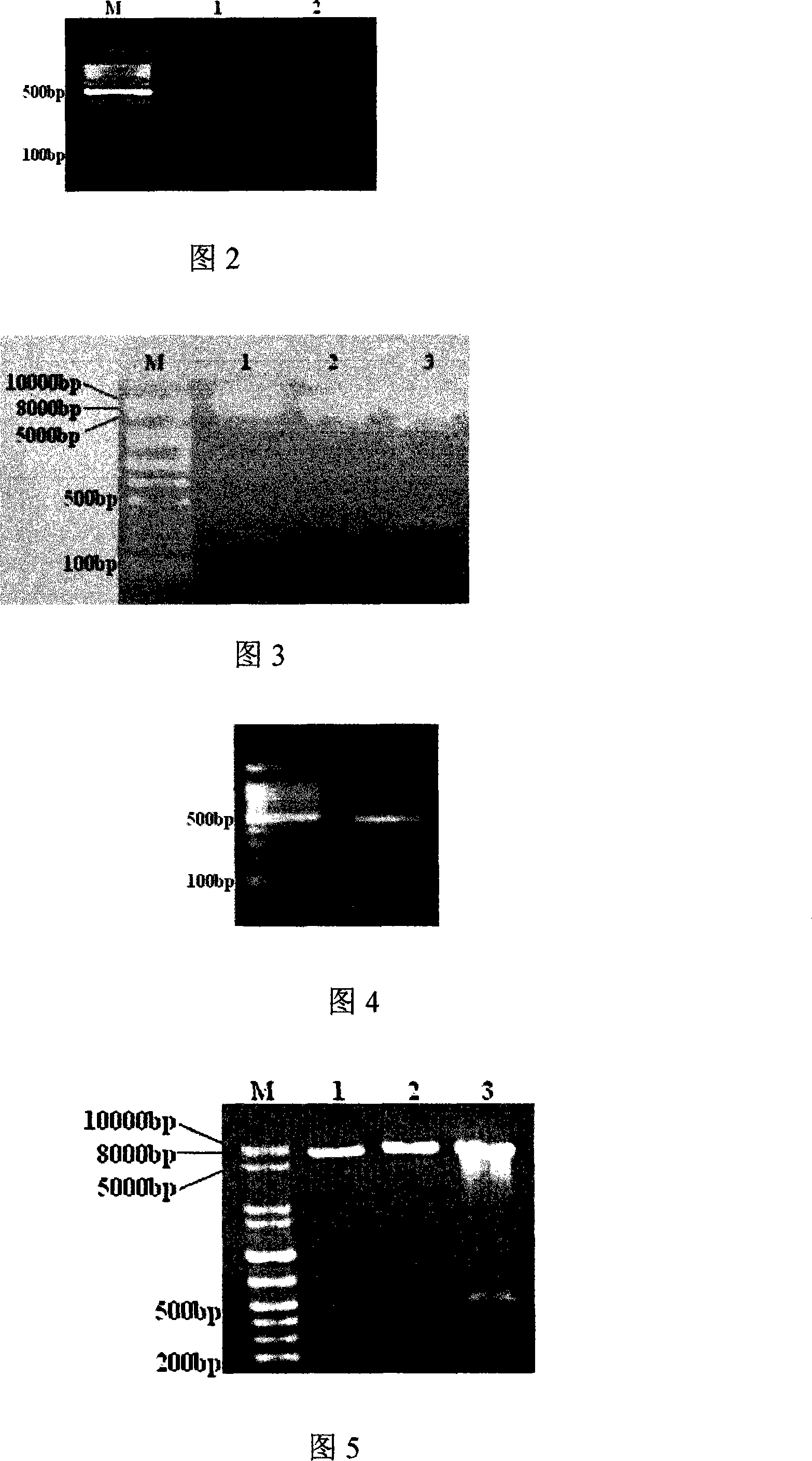 Acute progranulocyte leukemia DNA vaccine PML-RAR alpha 384-hIL-2 and preparing method and application thereof