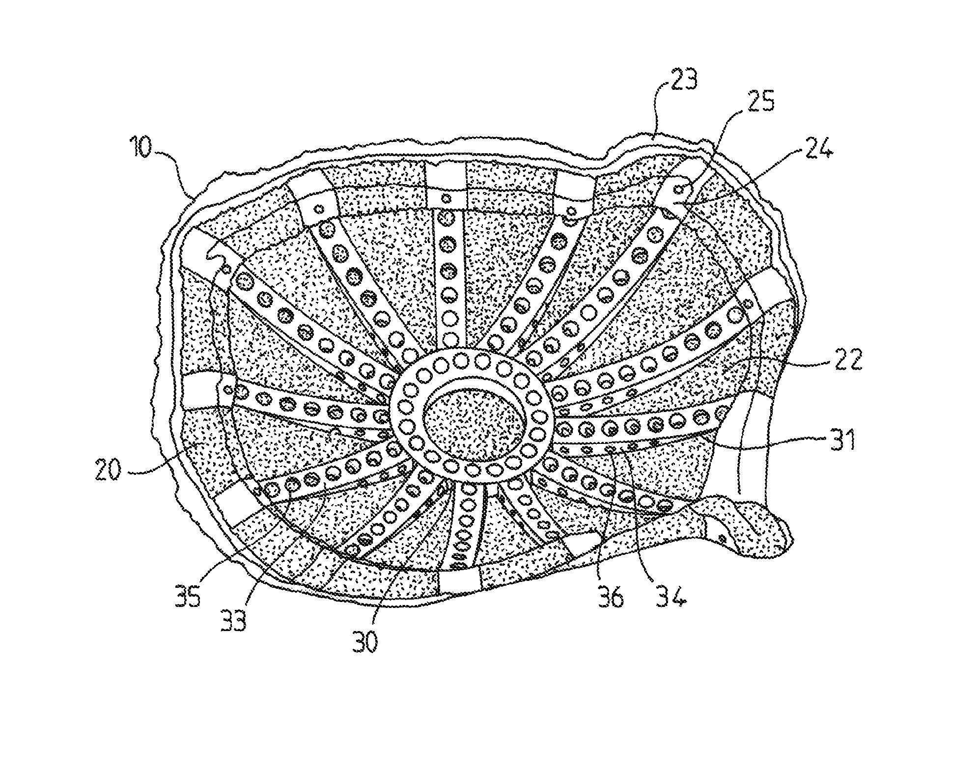 Reinforced biocompatible ceramic implant and manufacturing method thereof