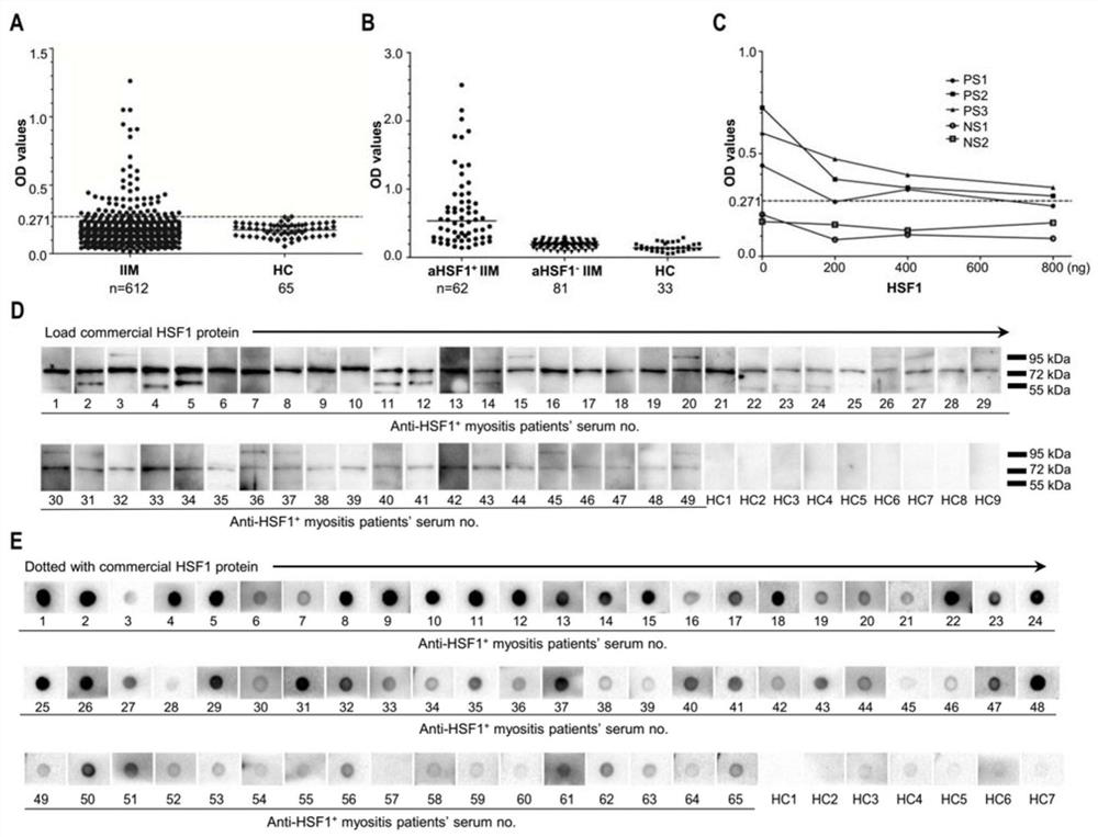 A molecular marker for diagnosing idiopathic inflammatory myopathy and its application