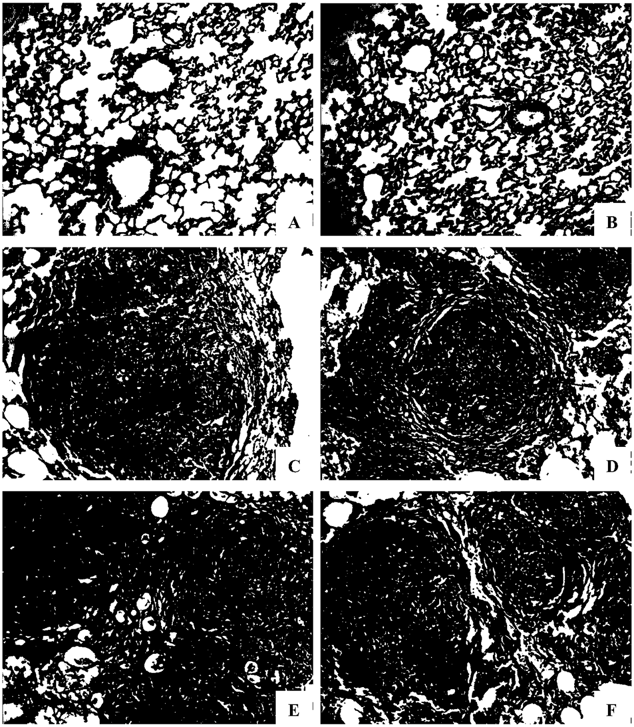 Preparation method of standard quartz powder used for copying silicosis model