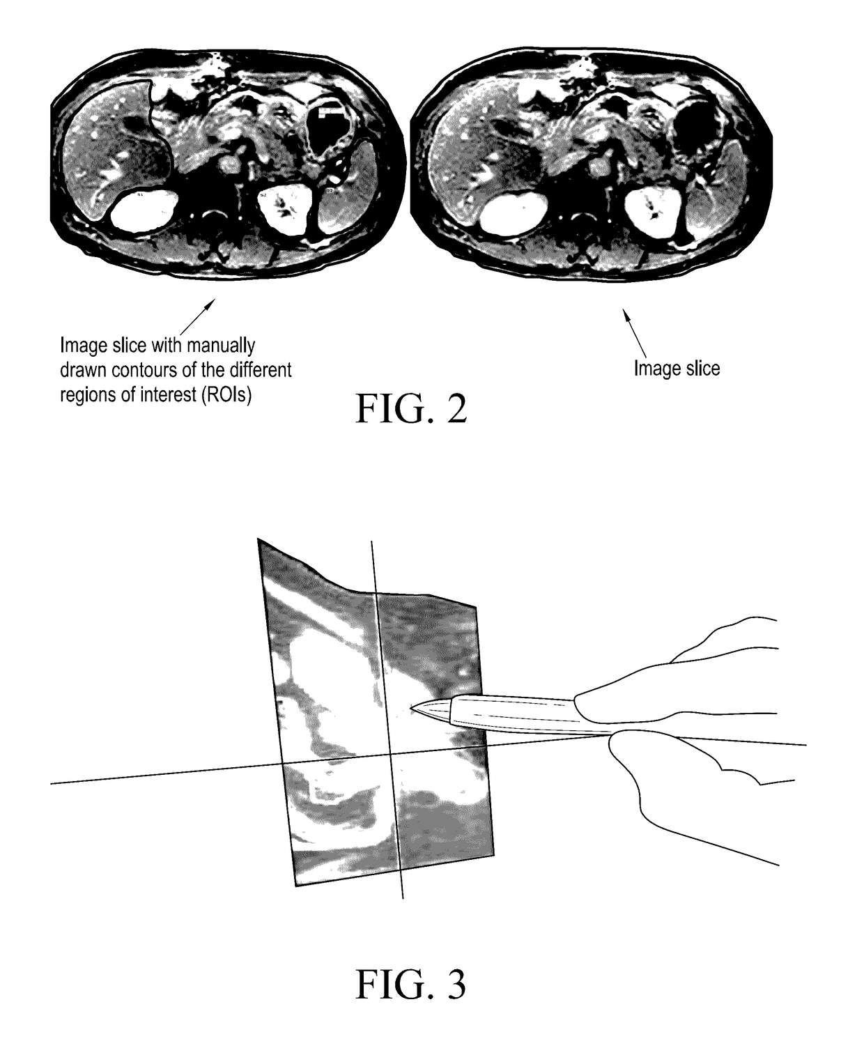 Automatic quality checks for radiotherapy contouring