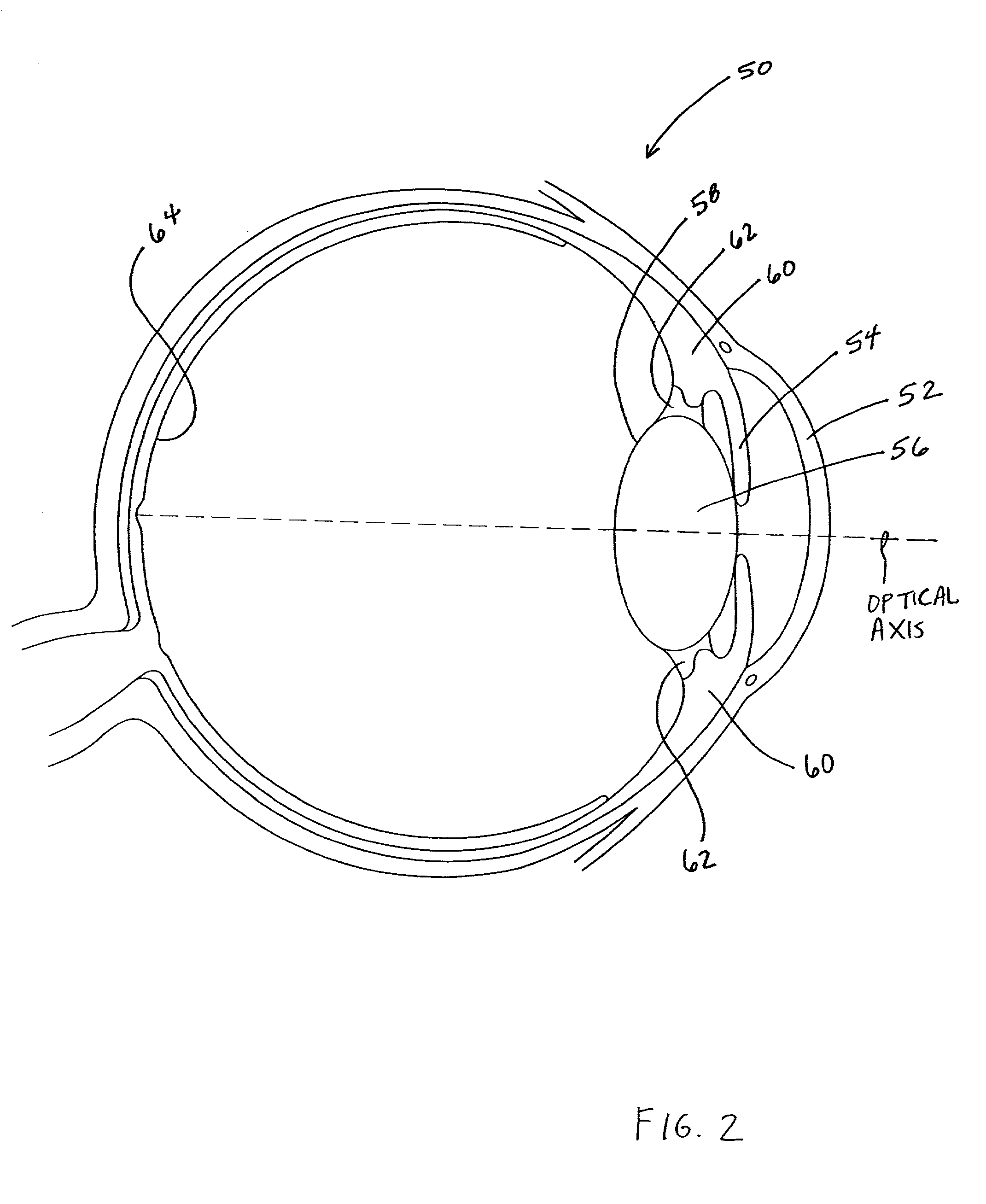 Connection geometry for intraocular lens system