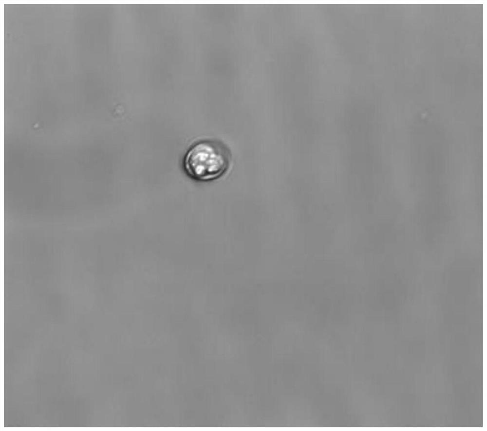 Recombinant coccidiosis vector for expressing alpha toxin protein and fluorescent tag protein and detection method of recombinant coccidiosis vector