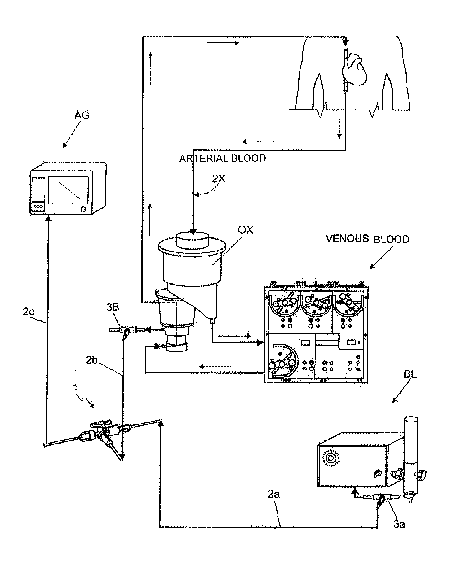 Oximetry and capnography system applied to extracorporeal circulation - ecc - procedure