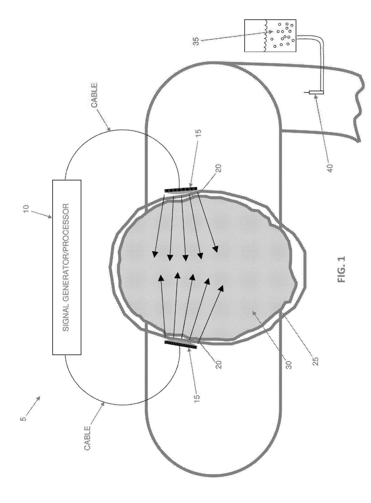 Automated ultrasound apparatus and method for noninvasive vessel recanalization treatment and monitoring