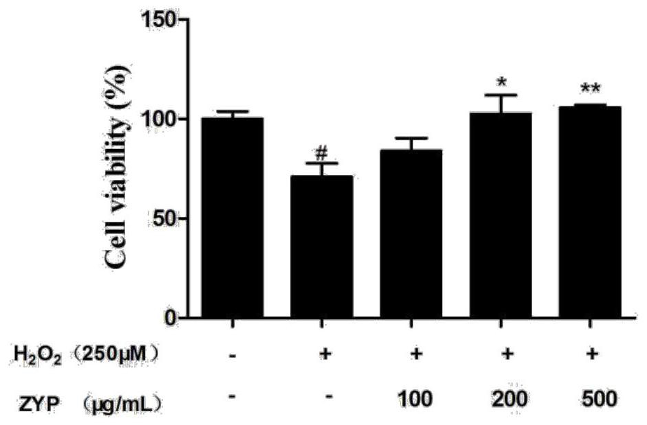 Pharmaceutical composition for liver injury protection and application thereof