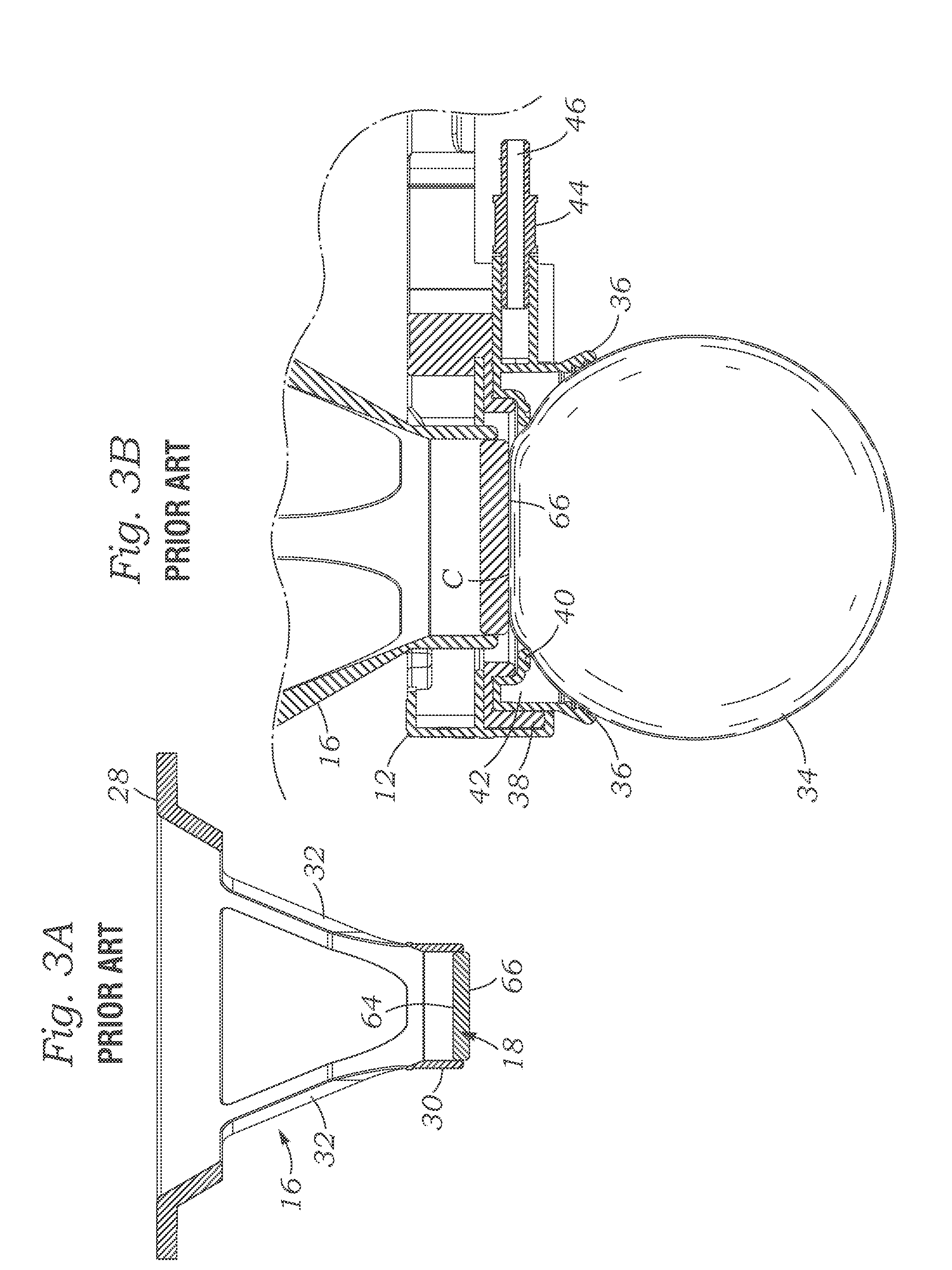 Hybrid ophthalmic interface apparatus