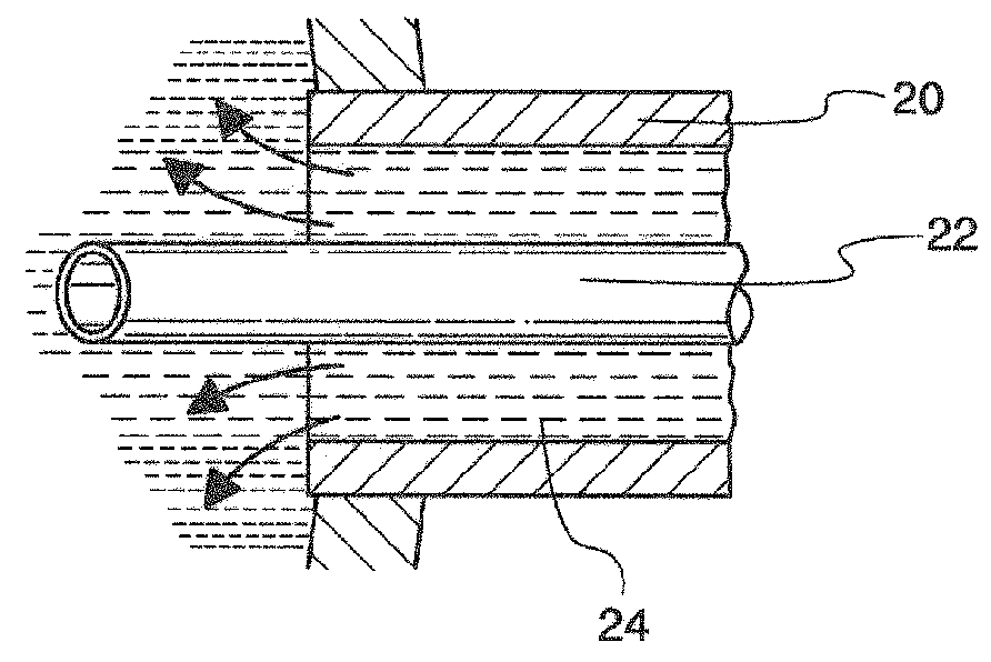 Infusion sleeve with distendable port