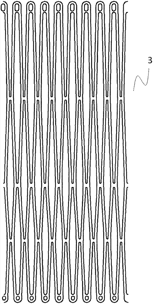 Pulmonary valve stent with anchoring mechanism