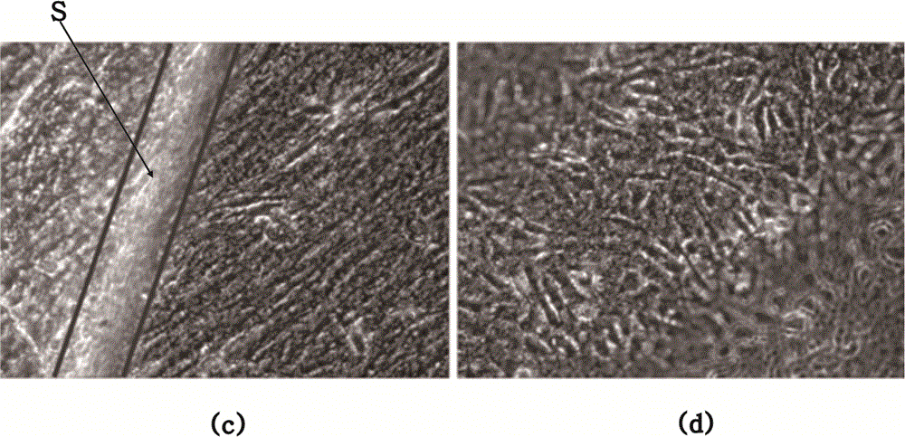 Chorion decellularizing liquid and decellularizing method