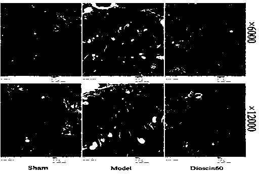 Application of dioscin to preparation of renal injury protection medicament