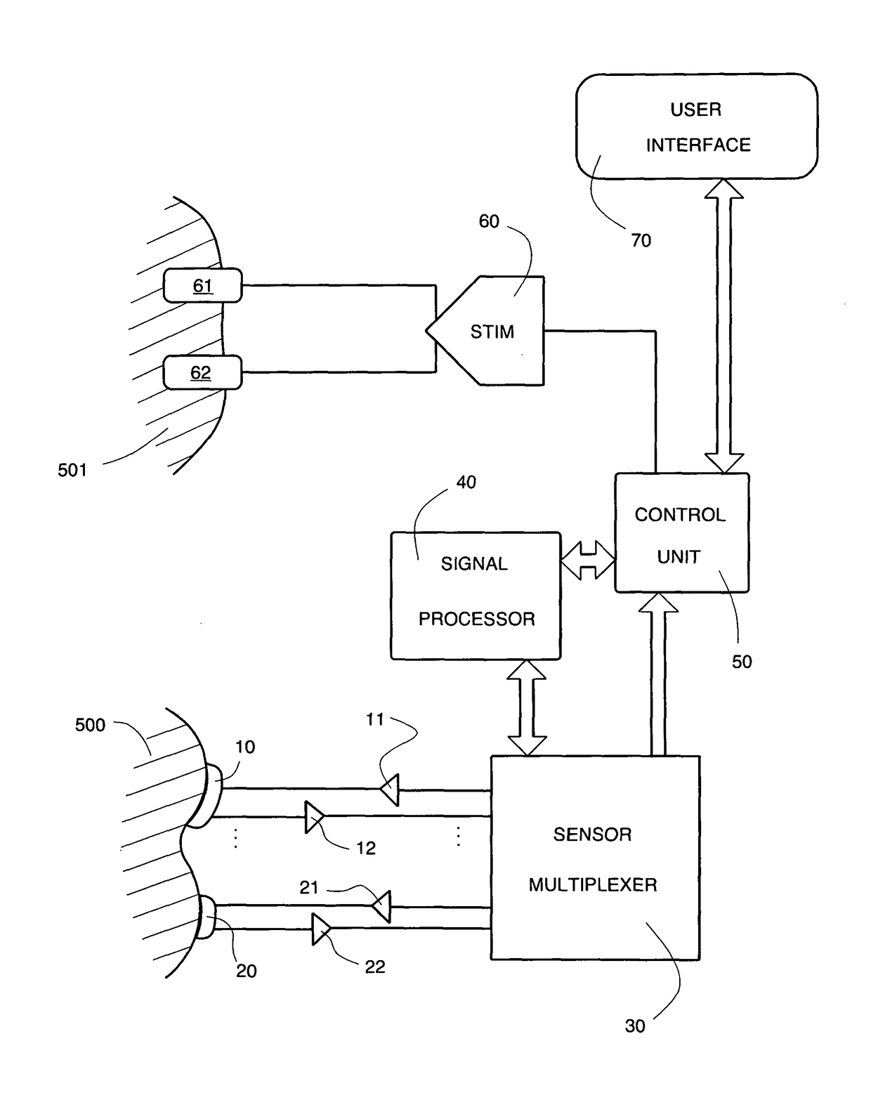 Apparatus and method for treating and preventing formation of pressure ulcers