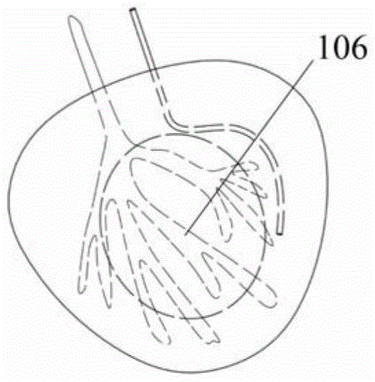 A heart simulation structure, its forming method and special mold