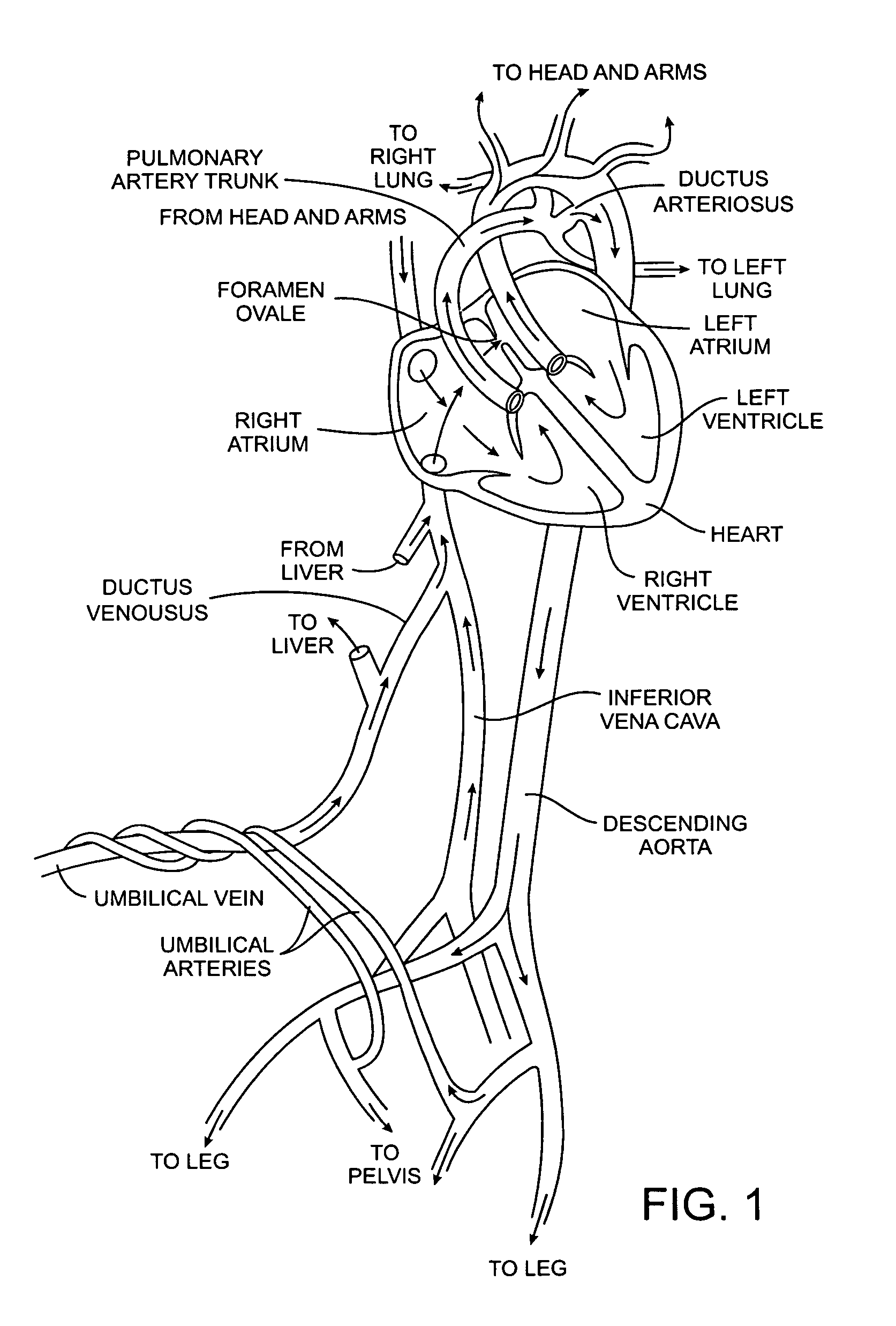 Methods and apparatus for treatment of patent foramen ovale