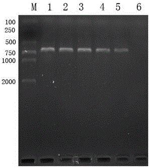 Actinobacillus pleuropneumoniae LAMP diagnostic kit