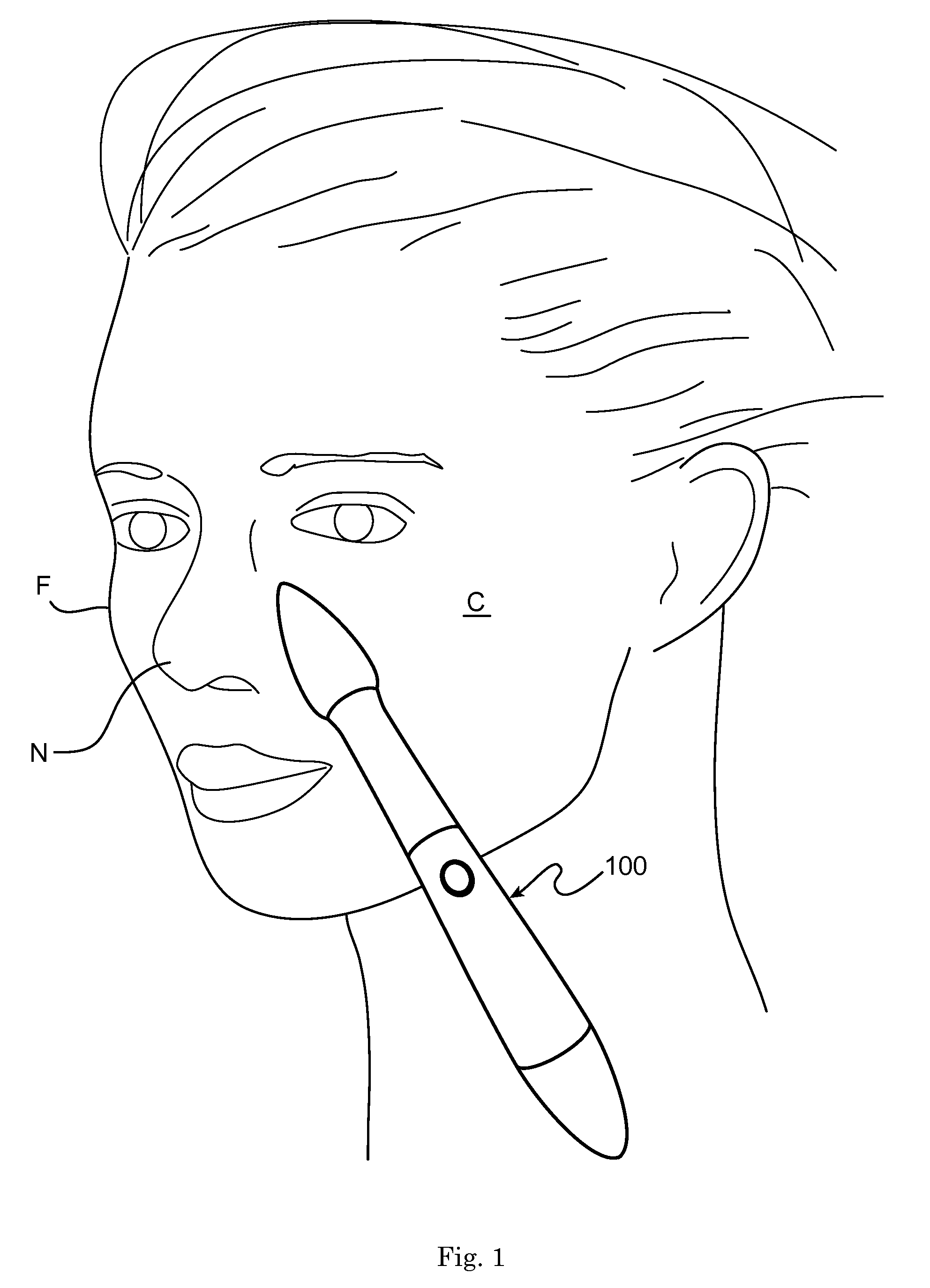 Skin treatment device