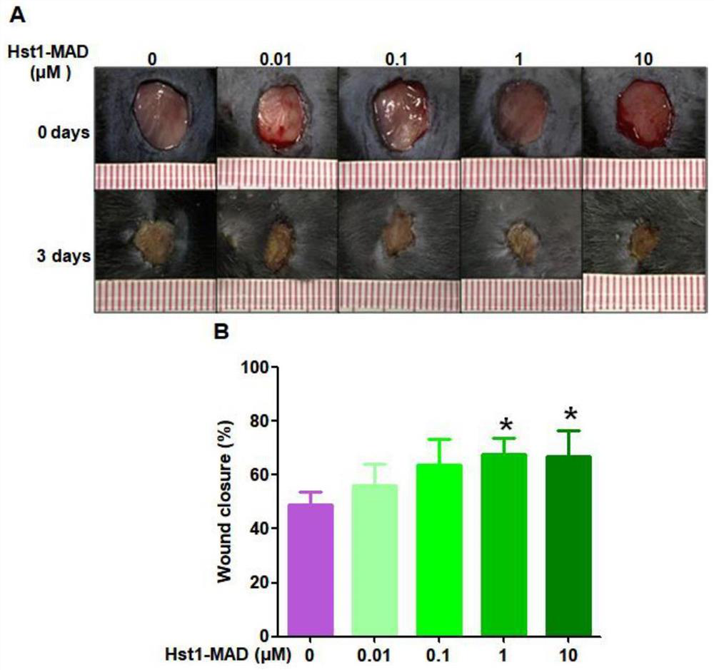 Application of polypeptide in preparation of product for promoting skin wound healing