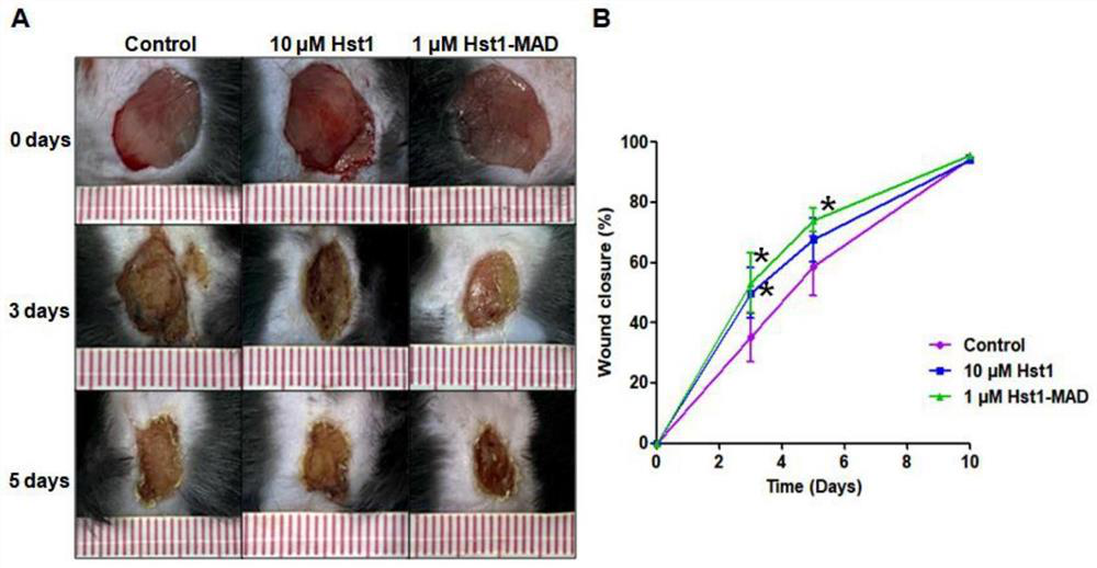 Application of polypeptide in preparation of product for promoting skin wound healing