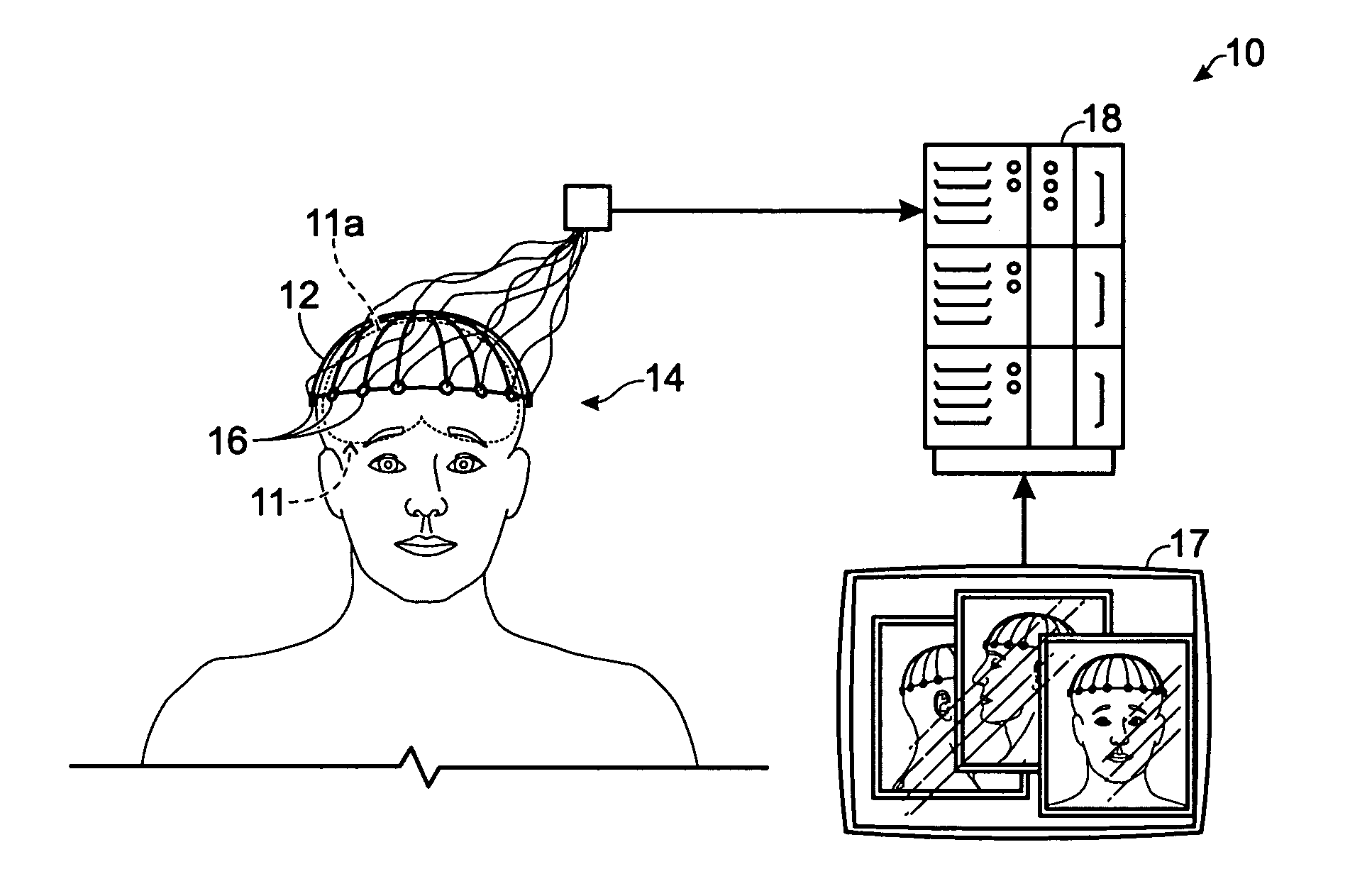 Method for locating tracts of electrical brain activity