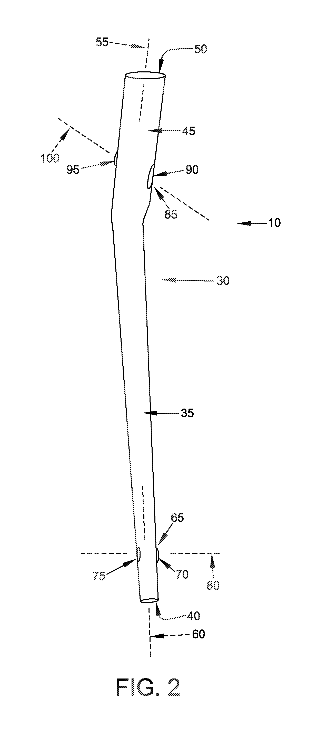 Interlocking intramedullary rod assembly for proximal femoral fractures, including unstable hip fractures