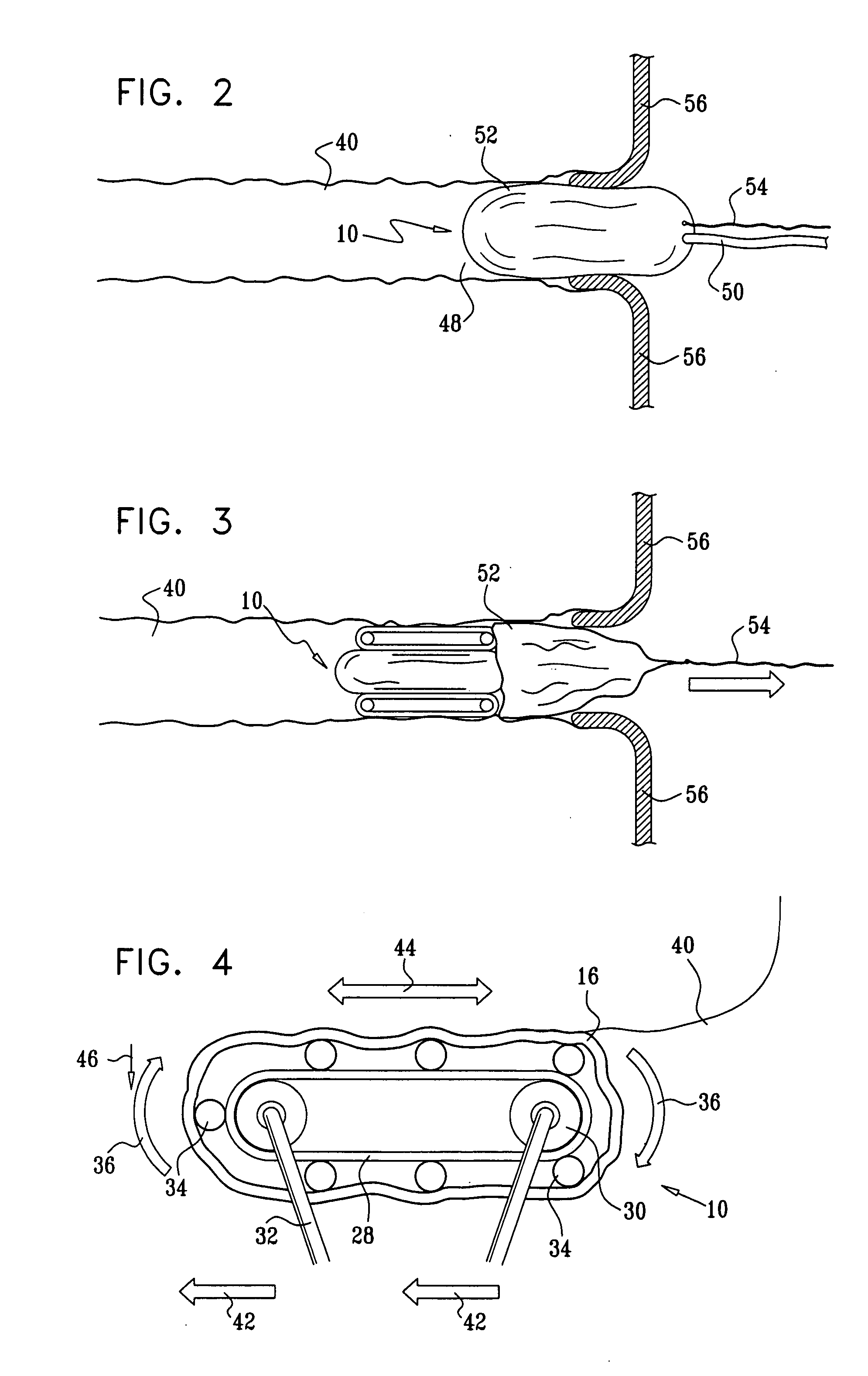 Gastrointestinal system with traction member