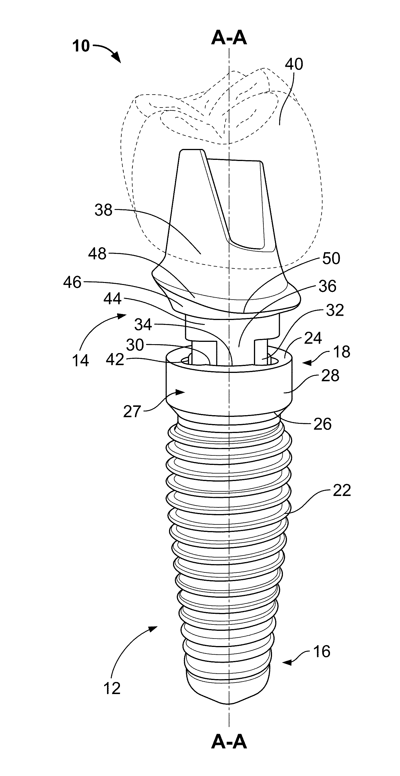 Modification of root form dental implants for accelerated tissue regeneration