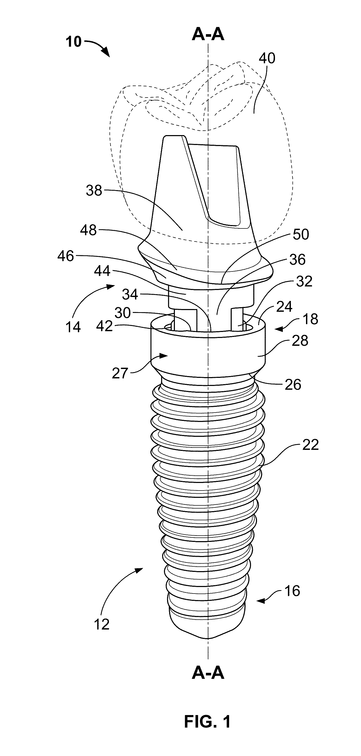 Modification of root form dental implants for accelerated tissue regeneration