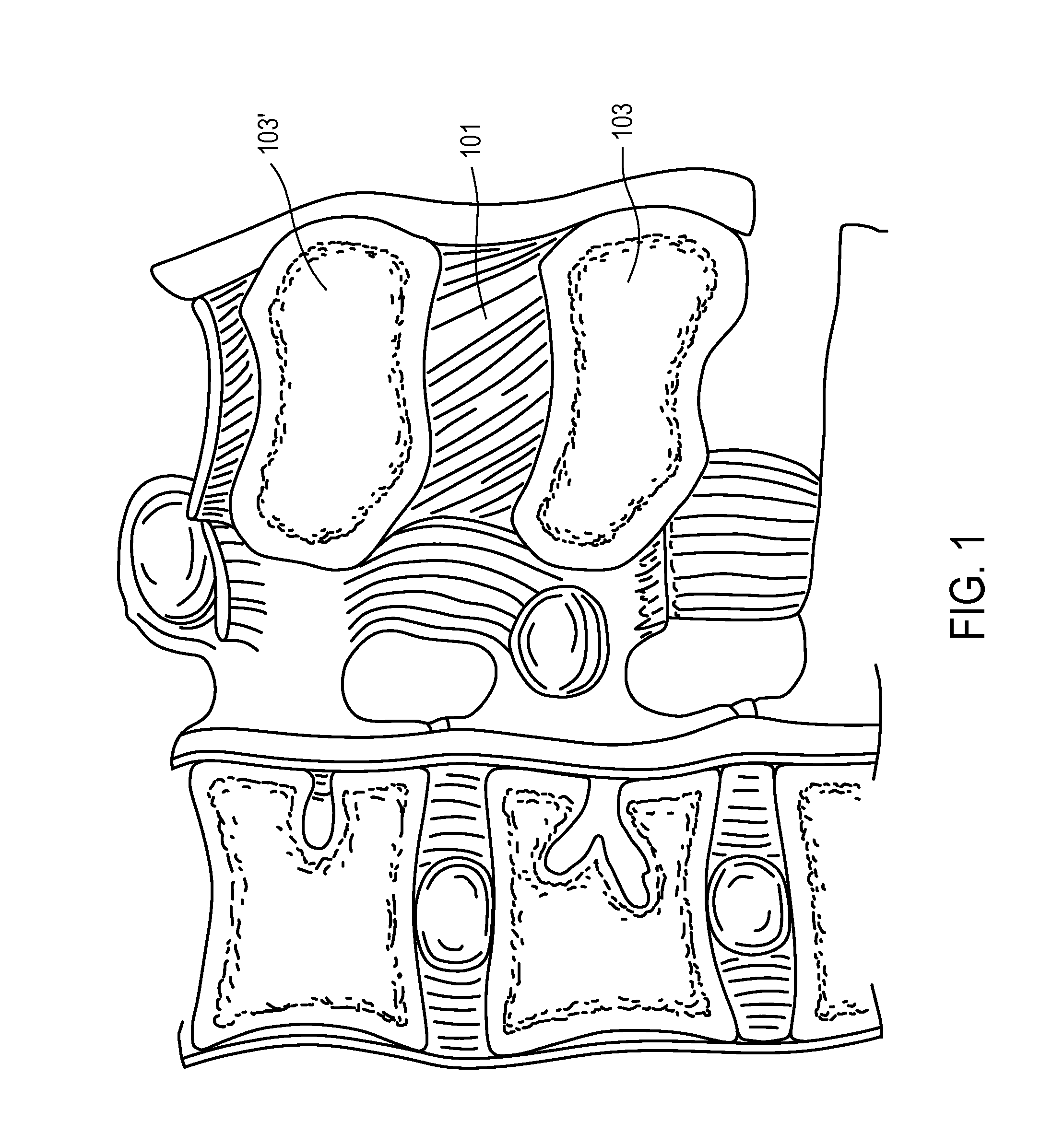 Access and tissue modification systems and methods