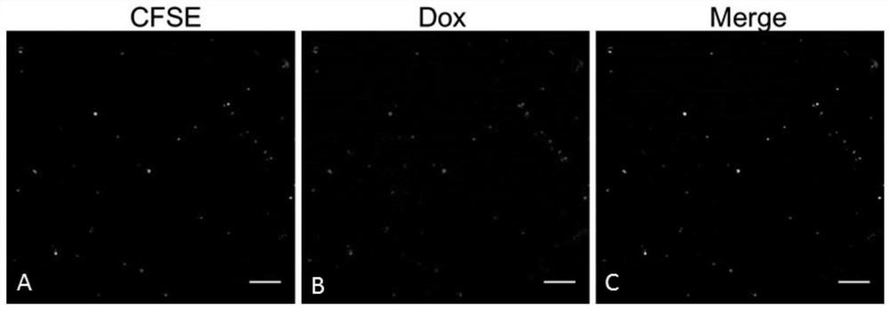 A tumor drug-loaded microparticle preparation and its preparation method