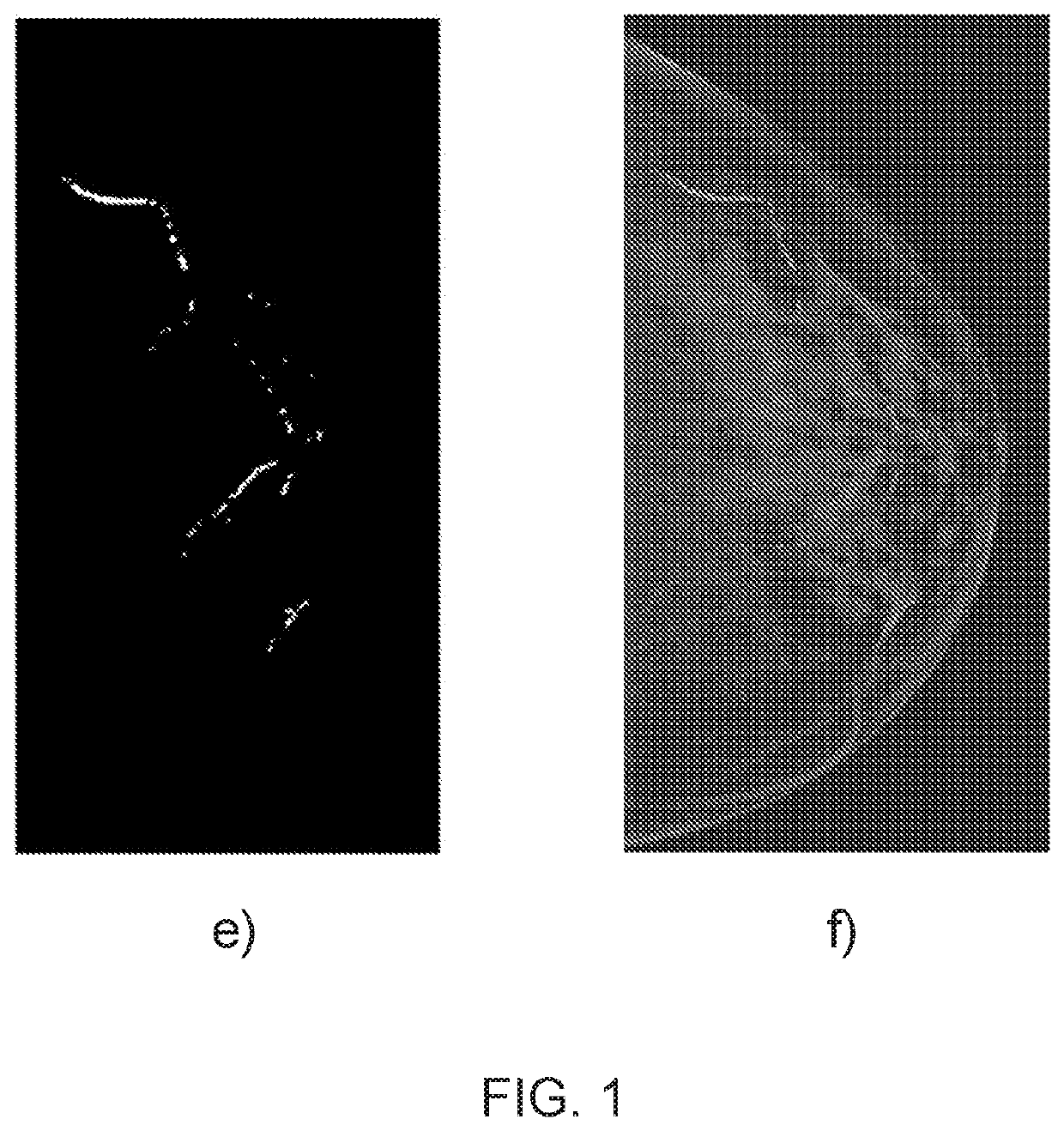 Method for detection and quantification of arterial calcification