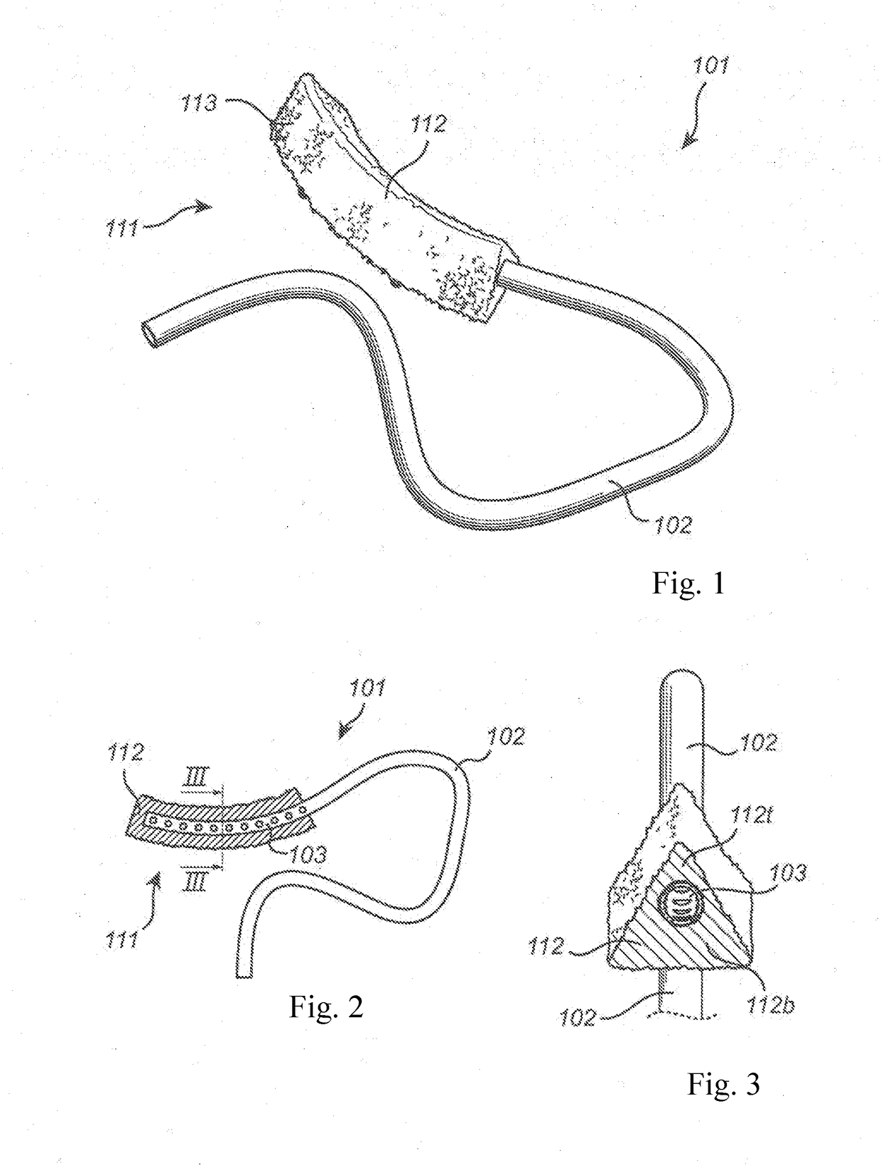 Dental suction arrangement