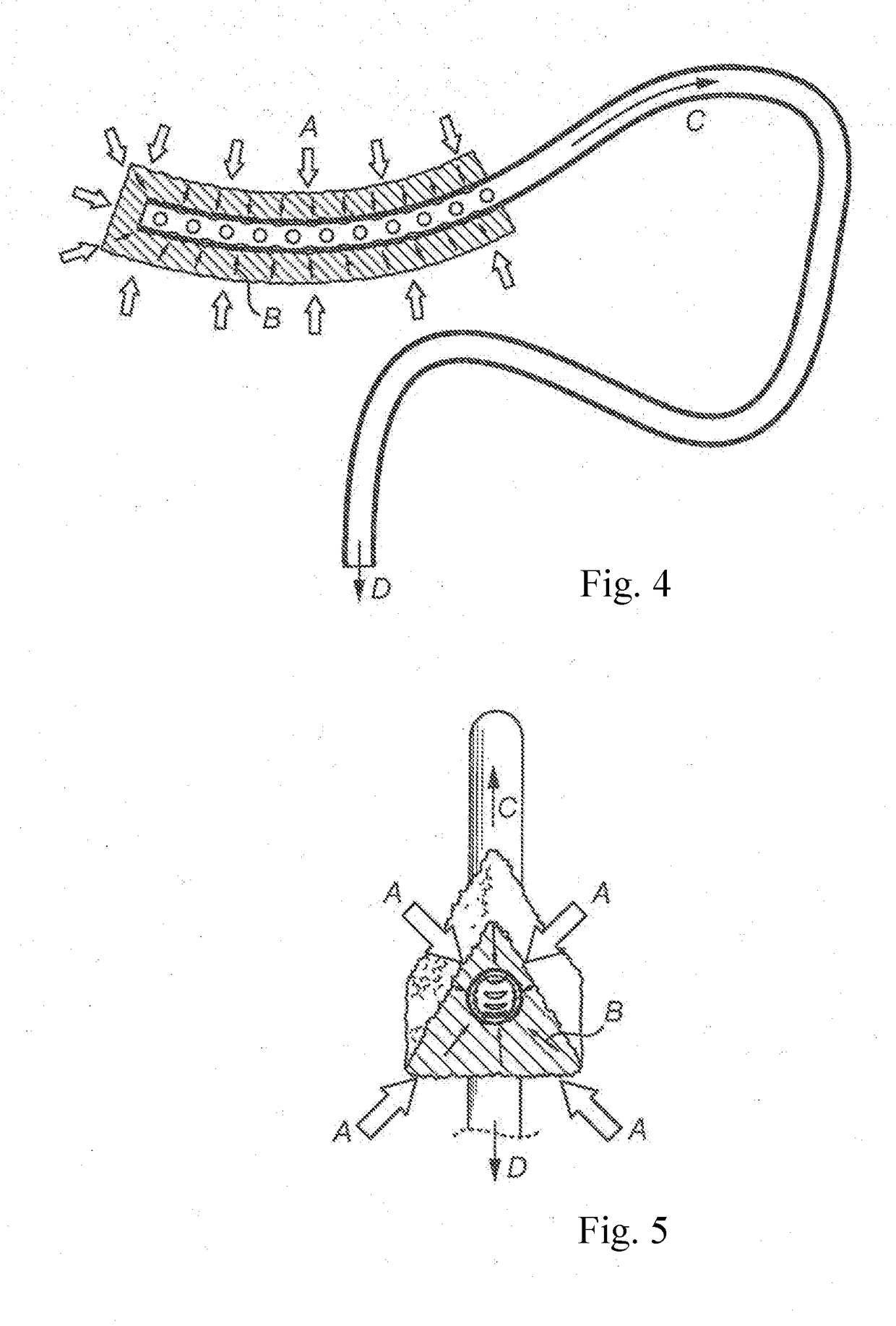 Dental suction arrangement