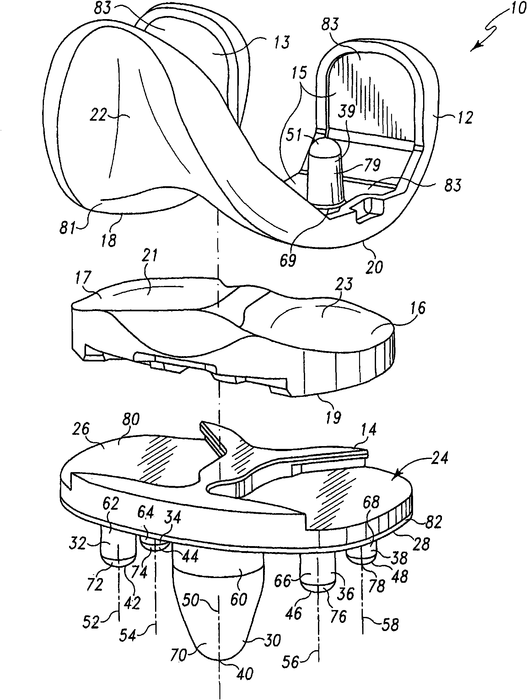 Prosthesis with surfaces having different textures and method of making the prosthesis