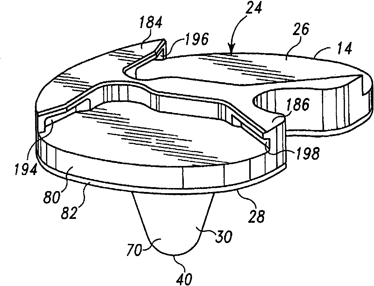 Prosthesis with surfaces having different textures and method of making the prosthesis