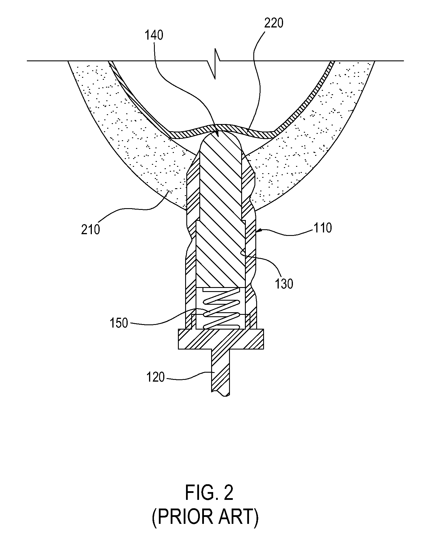 Apparatus for lifting maxillary sinus